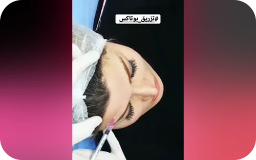 نمونه کار های کلینیک دکتر رادا خانیان 3