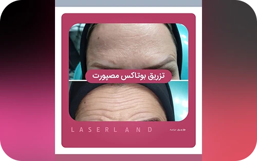 نمونه کار 3 کلینیک زیبایی لیزر لند