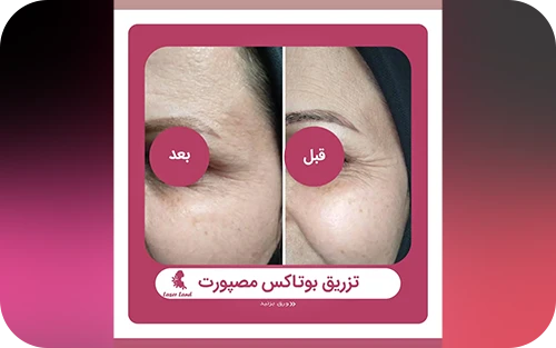نمونه کار کلینیک لیزر لند 2