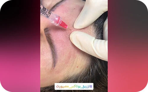 نمونه کار های کلینیک دکتر رادا خانیان 1