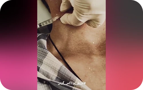 نمونه کار کلینیک زیبایی دکتر نازنین آرین 3