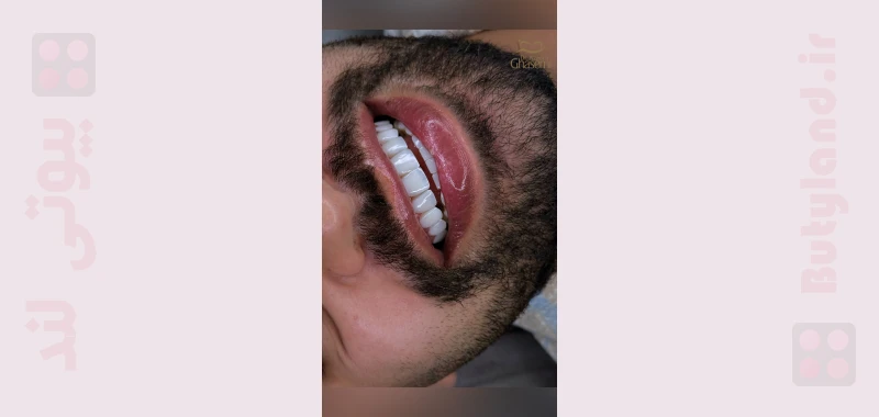 دندانپزشکی زیبایی دکتر آزاده قاسمی