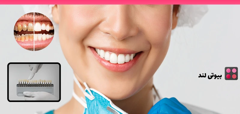 همه چیز درباره لمینت دندان: از انتخاب تا اجرا