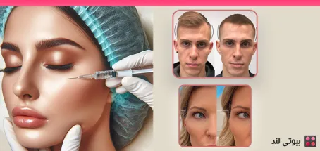 تزریق ژل شقیقه: بررسی کامل مزایا و معایب