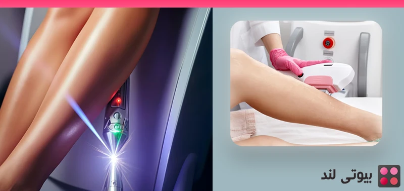 لیزر موهای زائد: چطور نتایج دائمی بگیریم؟