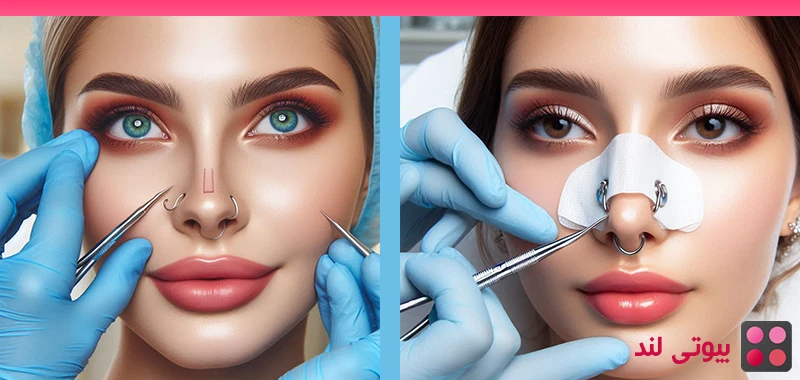 دلایل خوب برای جراحی بینی