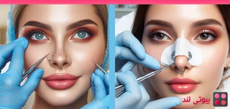 دلایل خوب برای جراحی بینی