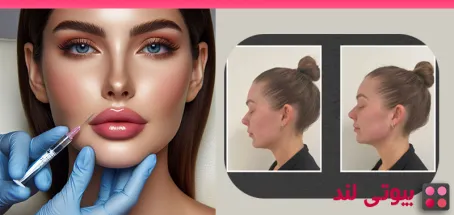همه چیز درباره تزریق فیلر زاویه فک