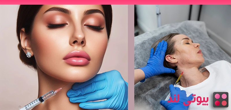 از بین بردن خطوط گردن (باندهای پلاتیسما) با تزریق بوتاکس