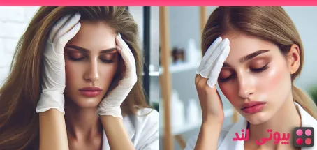 تزریق بوتاکس برای درمان میگرن