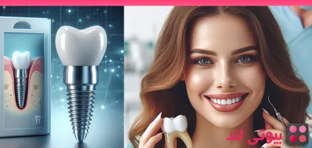 11 دلیل برای اینکه چرا باید ایمپلنت دندان را انتخاب کنید