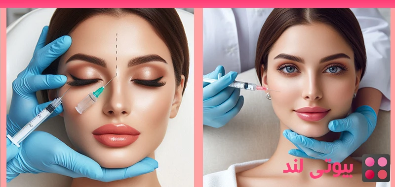 بوتاکس چگونه کار می کند؟