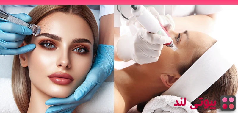 میکرونیدلینگ و مزوتراپی - بهترین درمان برای آکنه