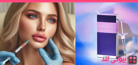 ماندگاری فیلر های لب ژوودرم (Juvéderm) چقدر است؟