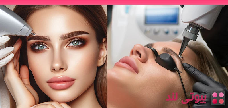 ابرو های بی عیب و نقص: لیزر مو های زائد ابرو