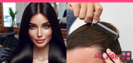ماینوکسیدیل: راه‌ حلی موثر برای ریزش مو