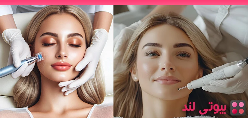 هر چند وقت یکبار می توانید میکرونیدلینگ انجام دهید؟
