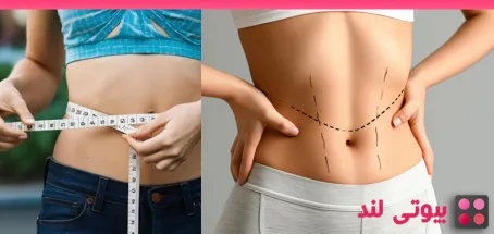 نکاتی در مورد مراقبت های بعد از لیپوساکشن