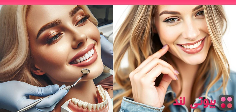 ماندگاری لمینت دندان چقدر است؟
