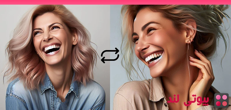5 روش دندانپزشکی برای جوانتر نشان دادن شما