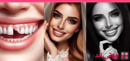 4 علت رایج افتادن دندان ها در بزرگسالی