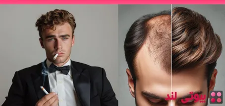 آیا سیگار بر نتایج کاشت مو تاثیر می‌ گذارد؟