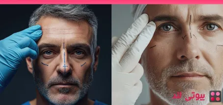 آیا مردان می توانند کاشت ابرو انجام دهند؟