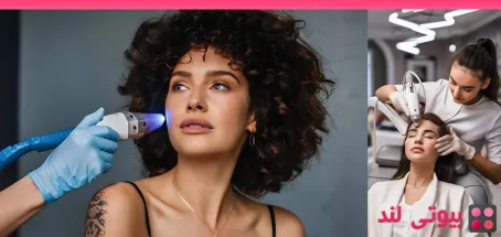 لایه برداری پوست با لیزر یا لایه برداری شیمیایی: کدام بهتر است؟