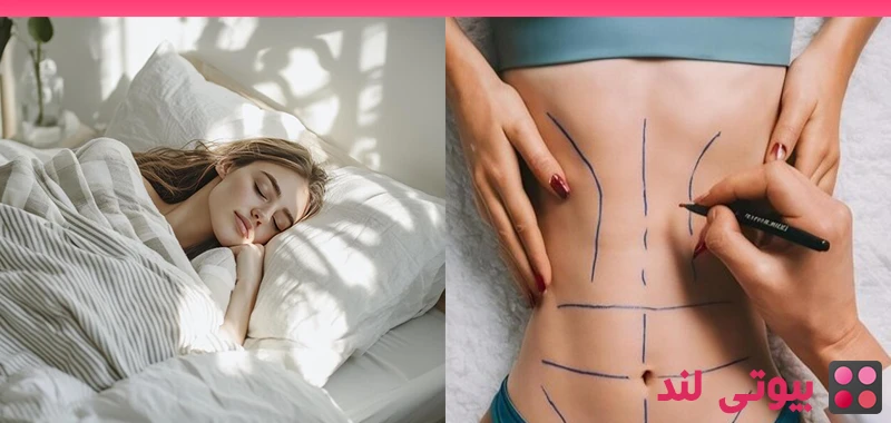 روش‌ های خوابیدن بعد از جراحی لیفت بدن