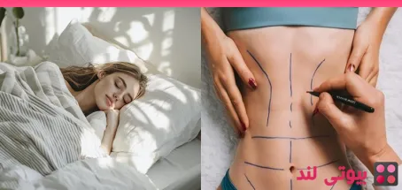 روش‌ های خوابیدن بعد از جراحی لیفت بدن