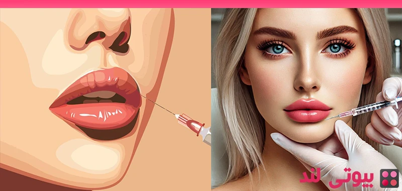 مراقبت های بعد از تزریق فیلر لب – نکات مهم بعد از تزریق