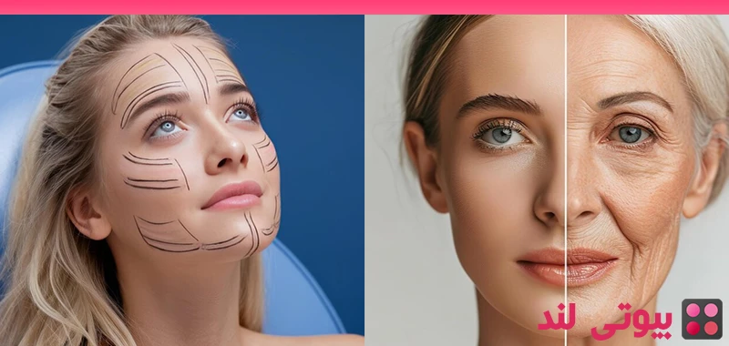 چگونه کبودی و تورم بعد از لیفت صورت را کاهش دهیم؟