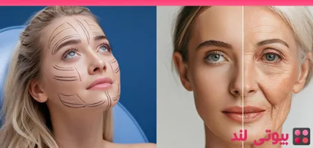 چگونه کبودی و تورم بعد از لیفت صورت را کاهش دهیم؟