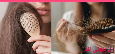 آیا کاهش وزن باعث ریزش مو می شود؟