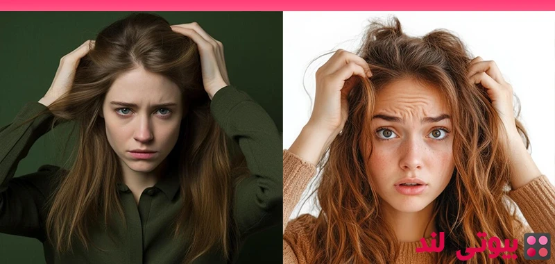 آیا مشکل تیروئید می تواند باعث ریزش مو شود؟