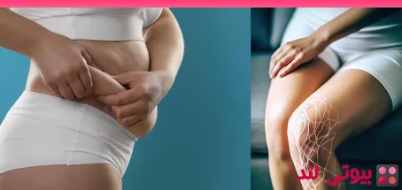 ۱۰ علت اصلی ایجاد سلولیت که باید بدانید