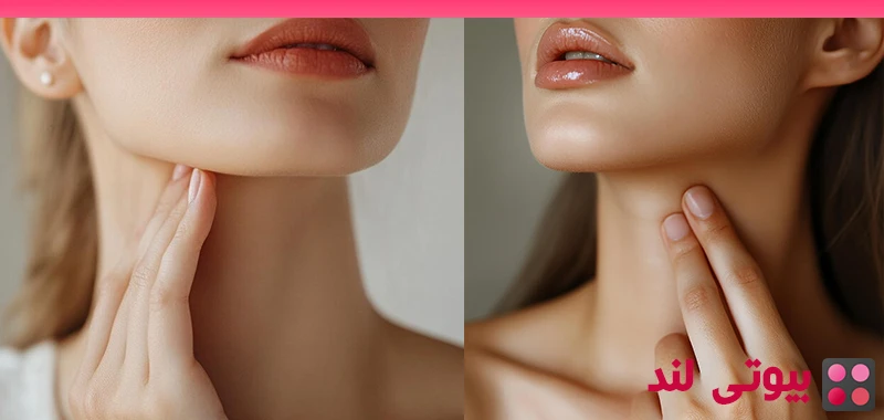 بوتاکس گردن: همه چیز درباره لیفت گردن با بوتاکس