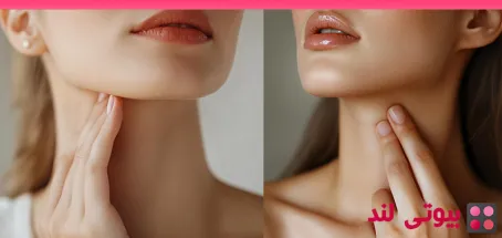 بوتاکس گردن: همه چیز درباره لیفت گردن با بوتاکس