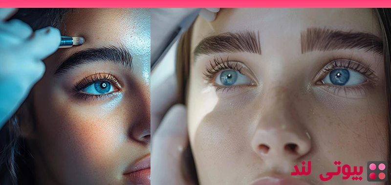تراکم فولیکول در کاشت ابرو؛ راز ابروهای طبیعی و پرپشت