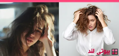 ۷ علت رایج ریزش مو در زنان و راه‌ های مقابله با آن