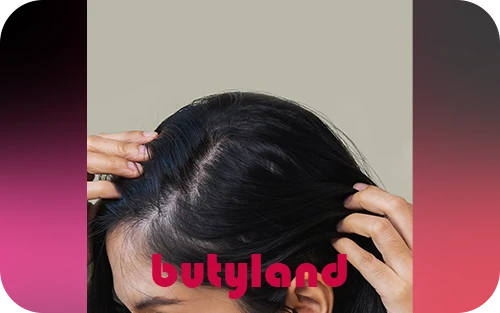 ۷ علت رایج ریزش مو در زنان و راه‌ های مقابله با آن