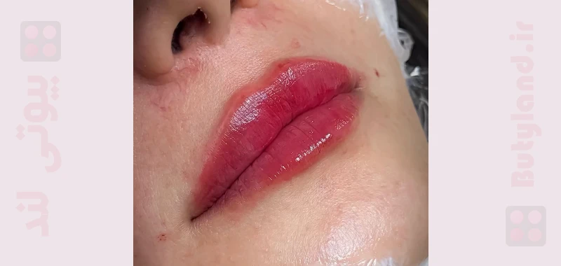 کلینیک تخصصی پوست و مو ماهان (مشهد)